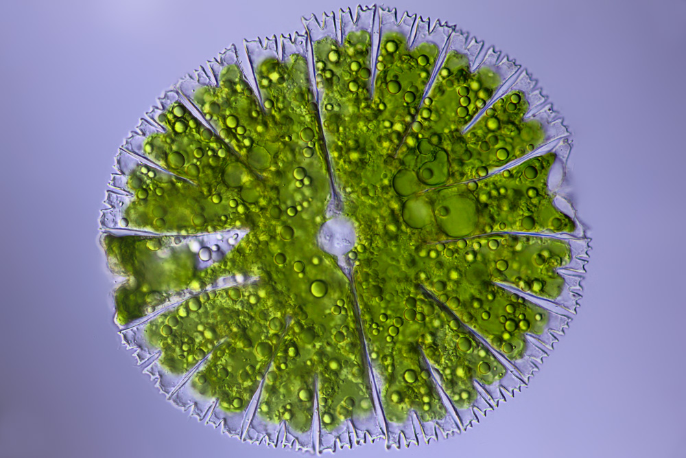 Одноклеточная брюс. Водоросль micrasterias. Микрастериас micrasterias. Десмидиевые водоросли. Харовая водоросль микрастериас.